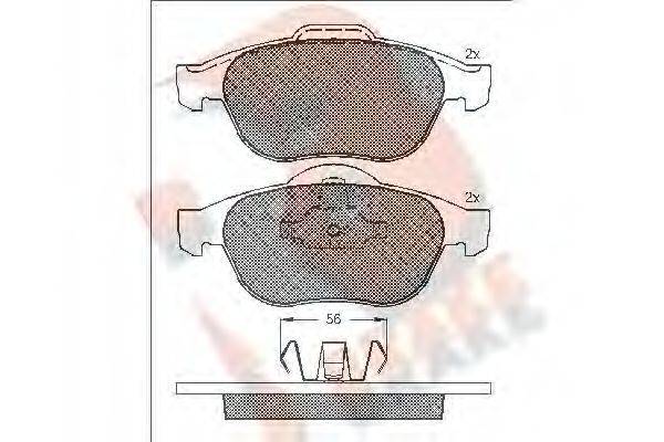 R BRAKE RB1533